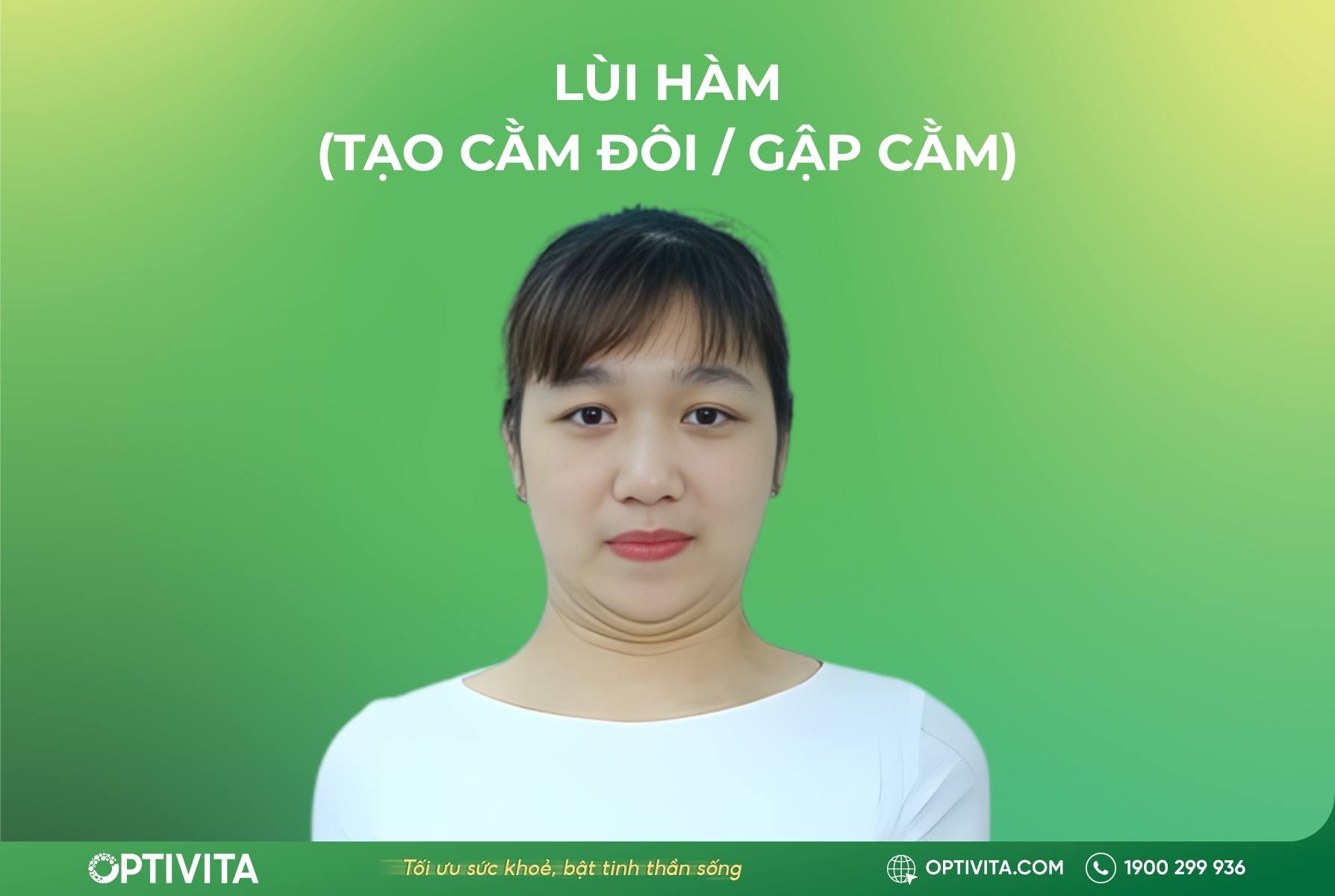 Bài tập 2: Lùi hàm (Tạo cằm đôi / Gập cằm)