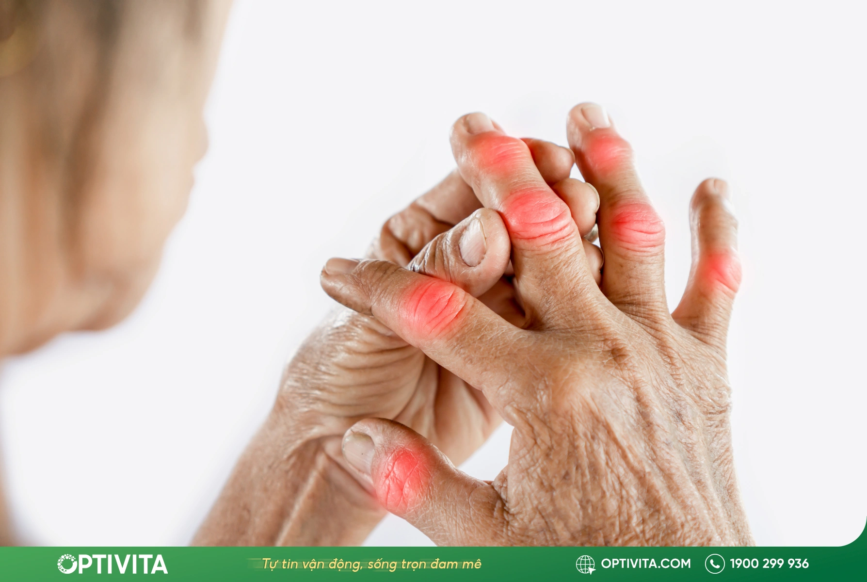 Dấu hiệu bạn cần biết cách giảm đau gout nhanh nhất