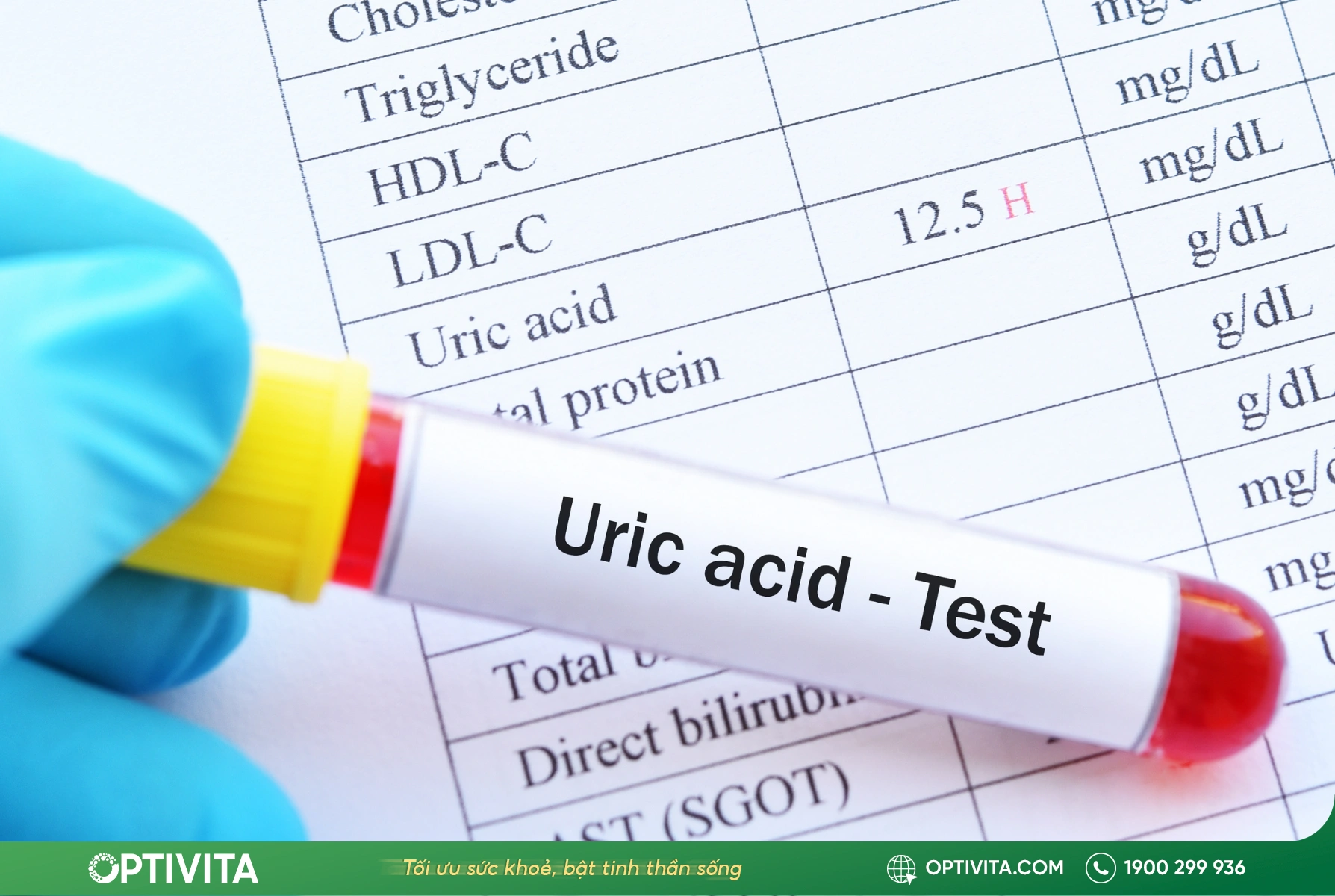 Acid uric là gì và vai trò