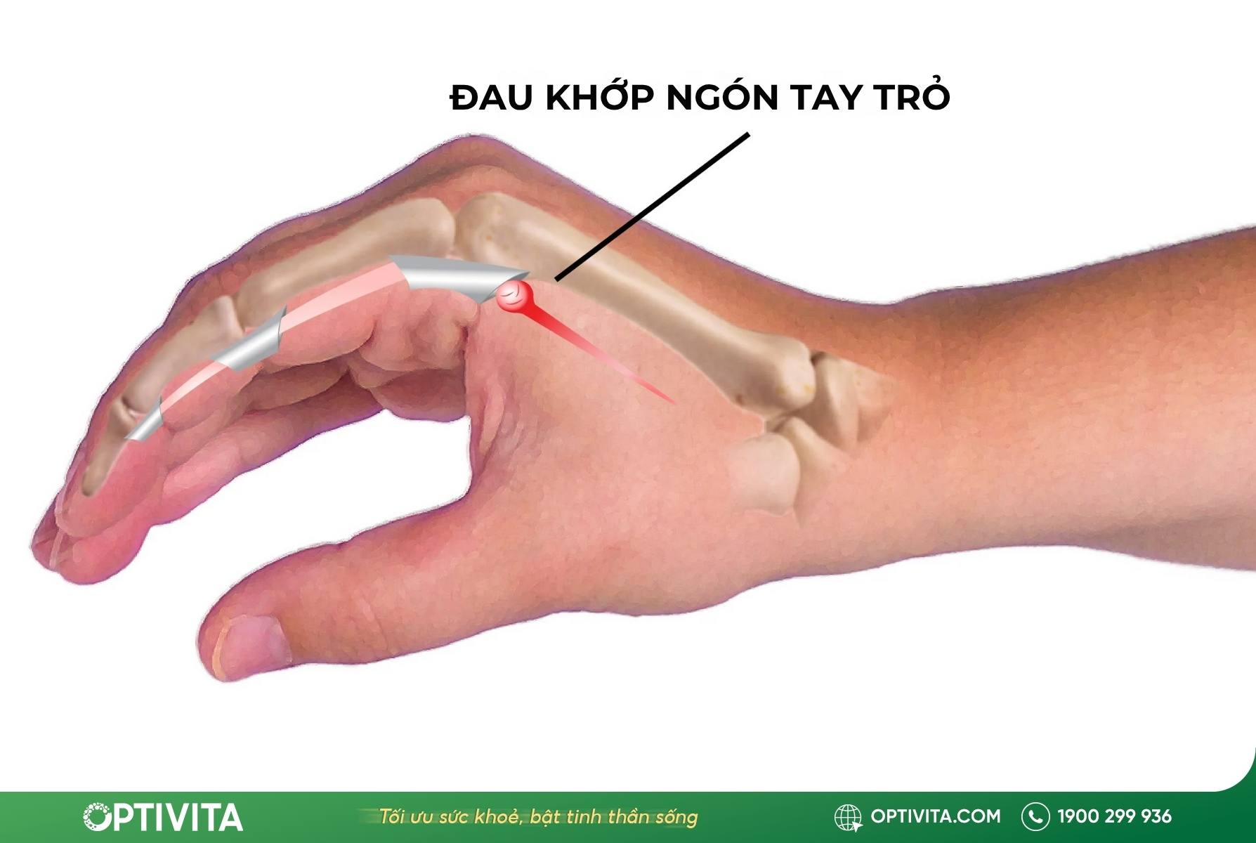 Khi nào ngón tay trỏ bị đau là dấu hiệu bệnh lý