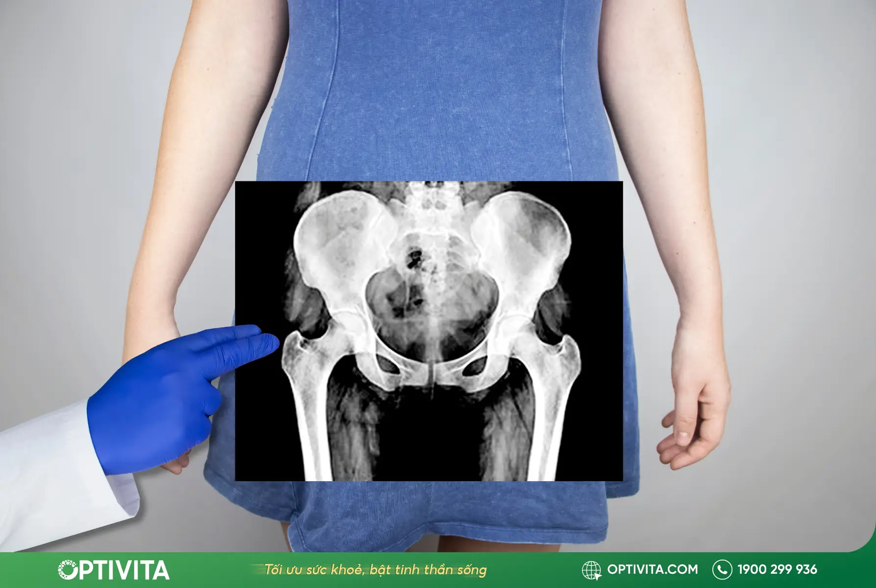 X-quang để chẩn đoán