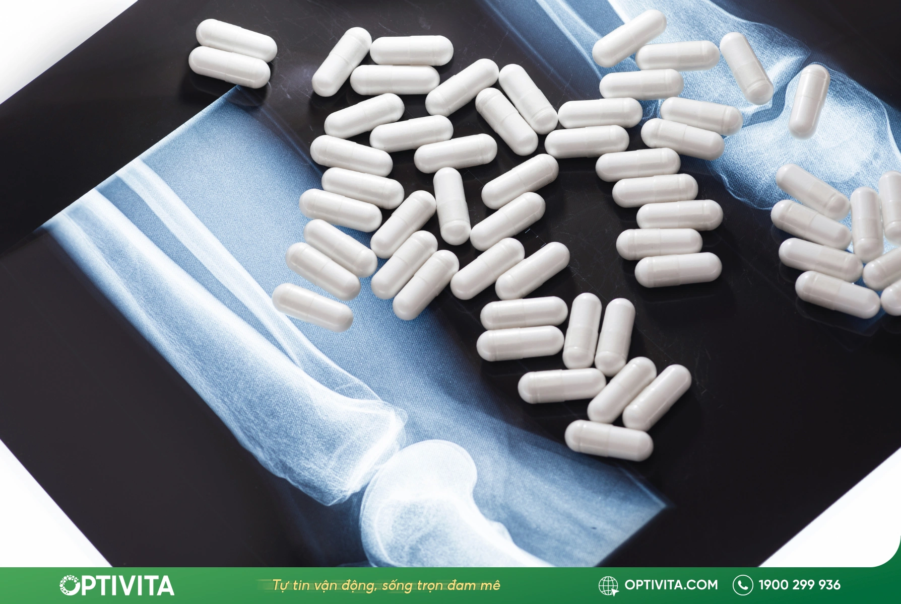 9 tác dụng phụ của Glucosamine thường gặp & cách hạn chế hiệu quả 7 bổ sung Glucosamine từ giúp tái tạo sụn khớp