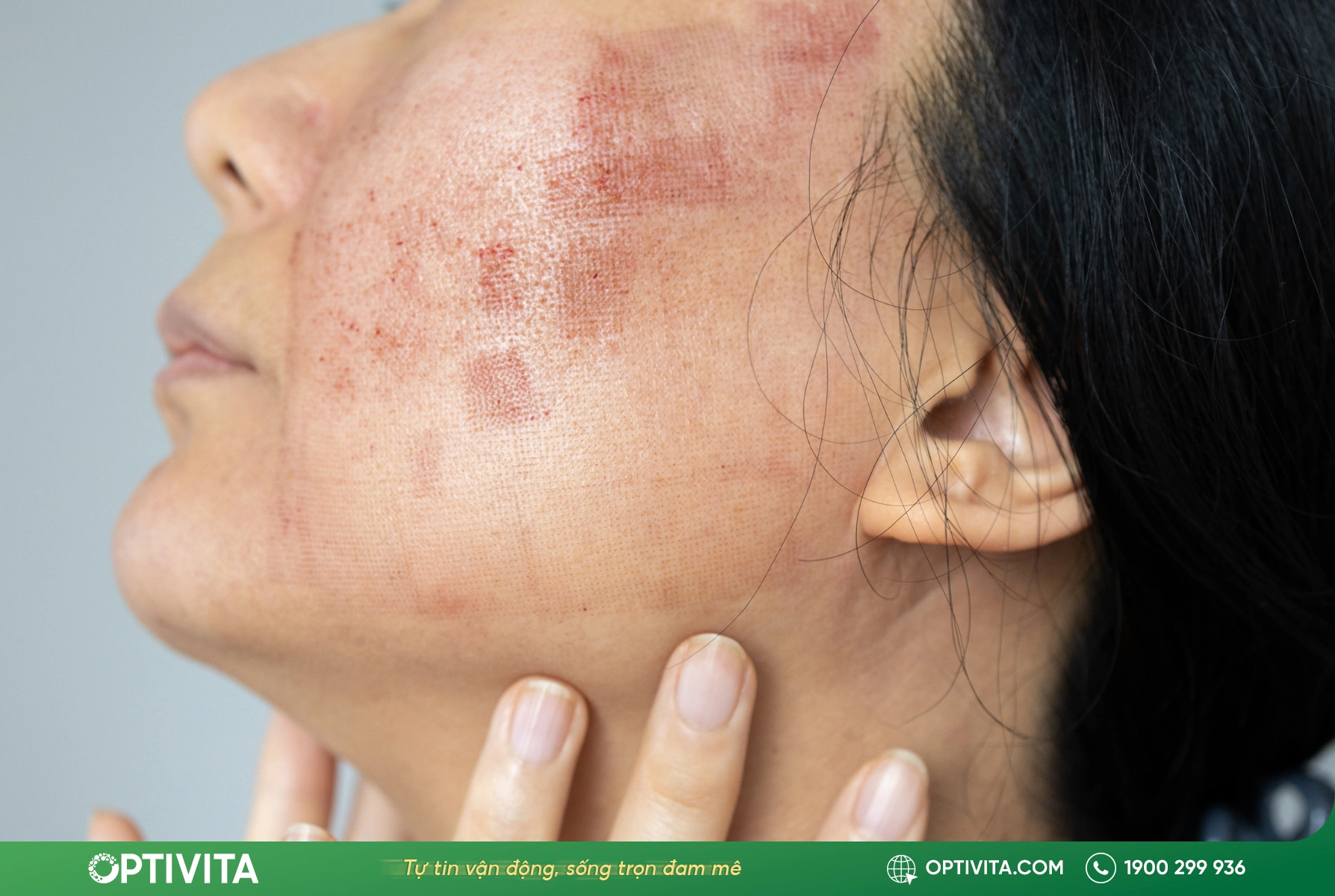 9 tác dụng phụ của Glucosamine thường gặp & cách hạn chế hiệu quả 8 tác dụng phụ của glucosamine đối với người dị ứng hải sản