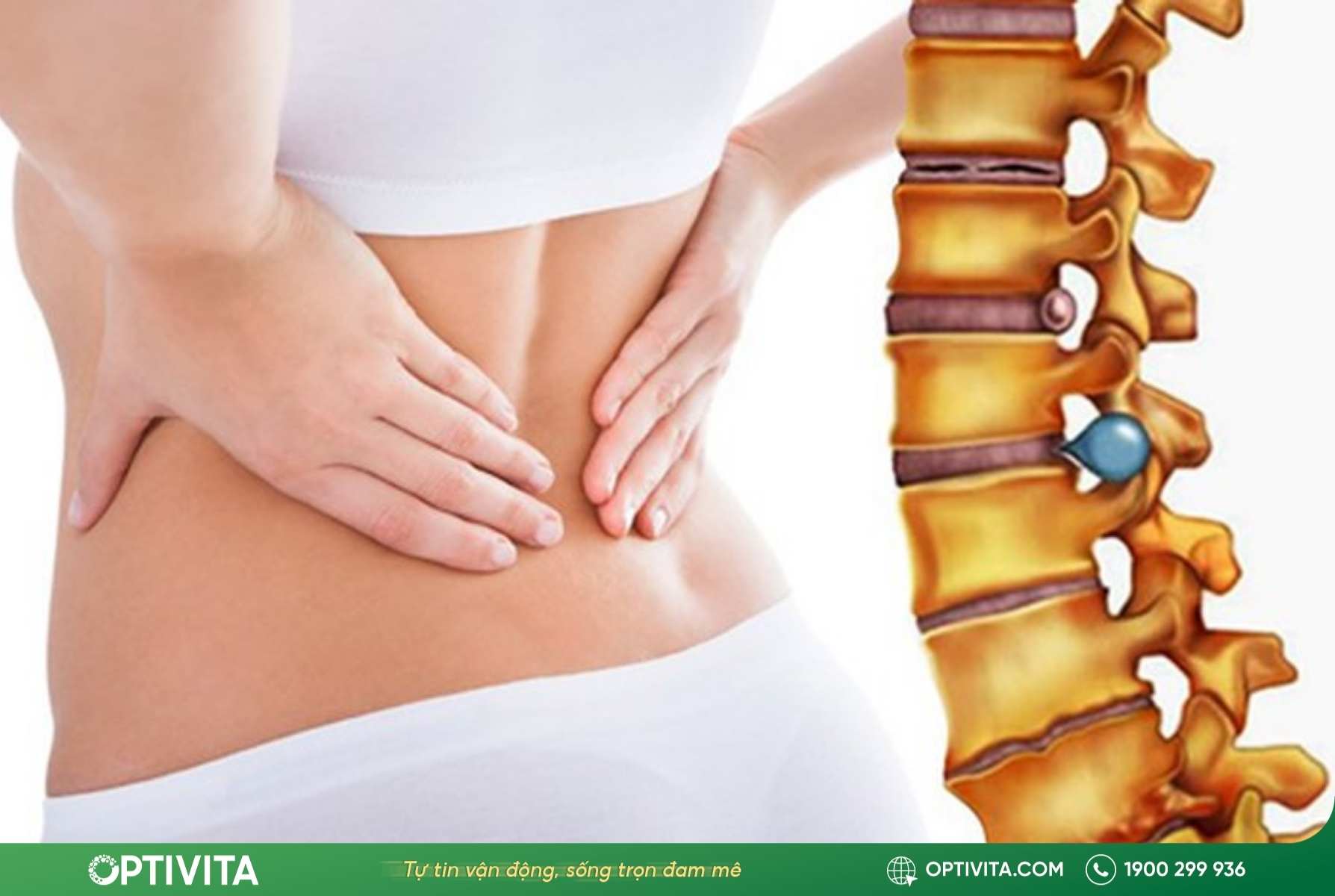 Thoát vị đĩa đệm khiến đau lưng không cúi được