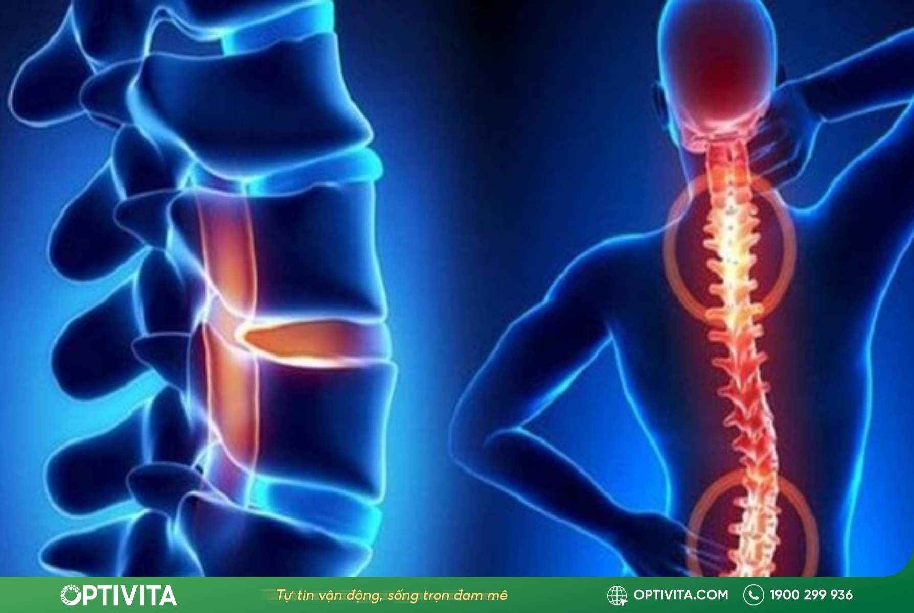 Hẹp ống sống là nguyên nhân đau lưng không cúi được