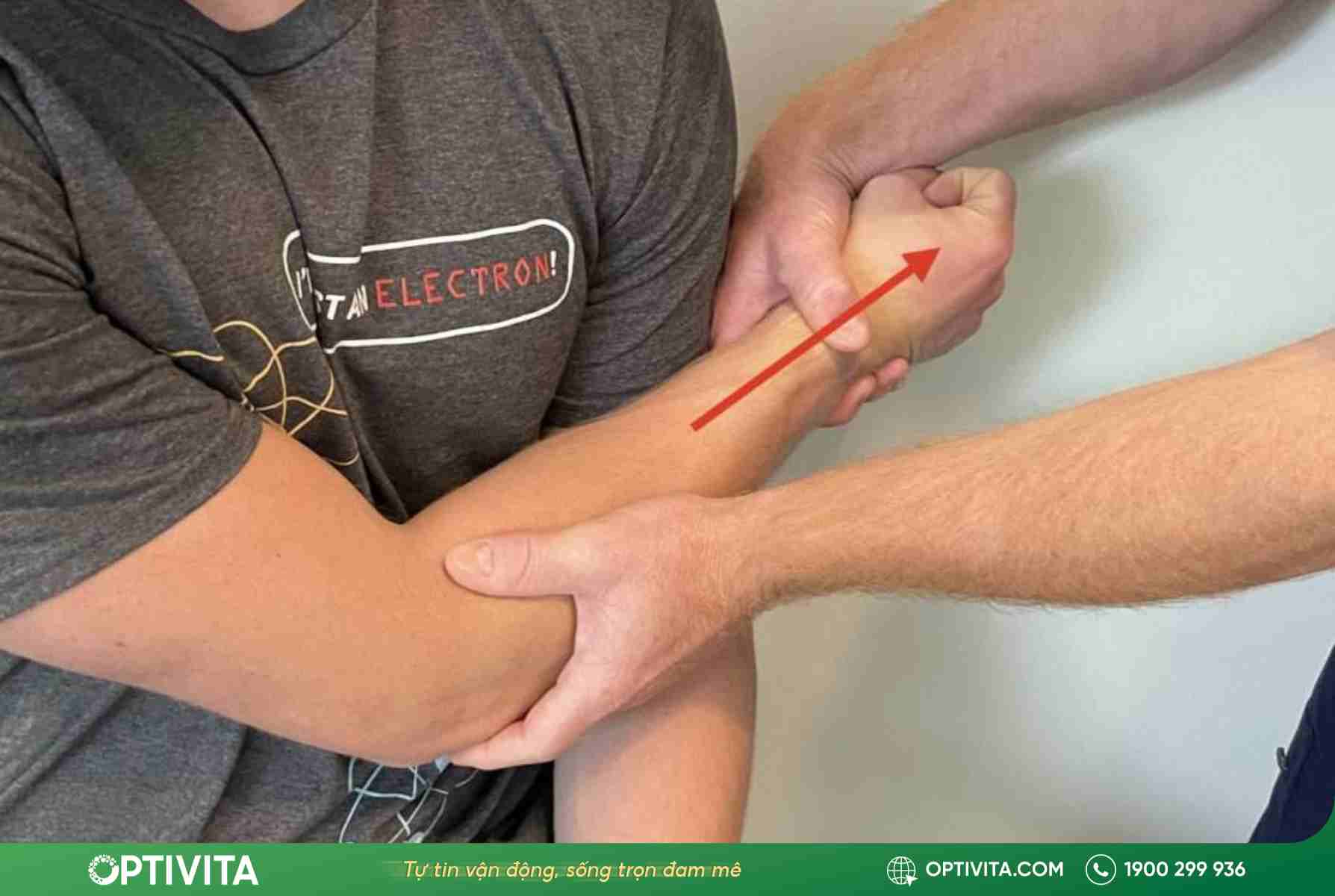 5 dấu hiệu trật khớp khuỷu tay & cách xử lý chuẩn y khoa 14 Trật khớp khuỷu tay