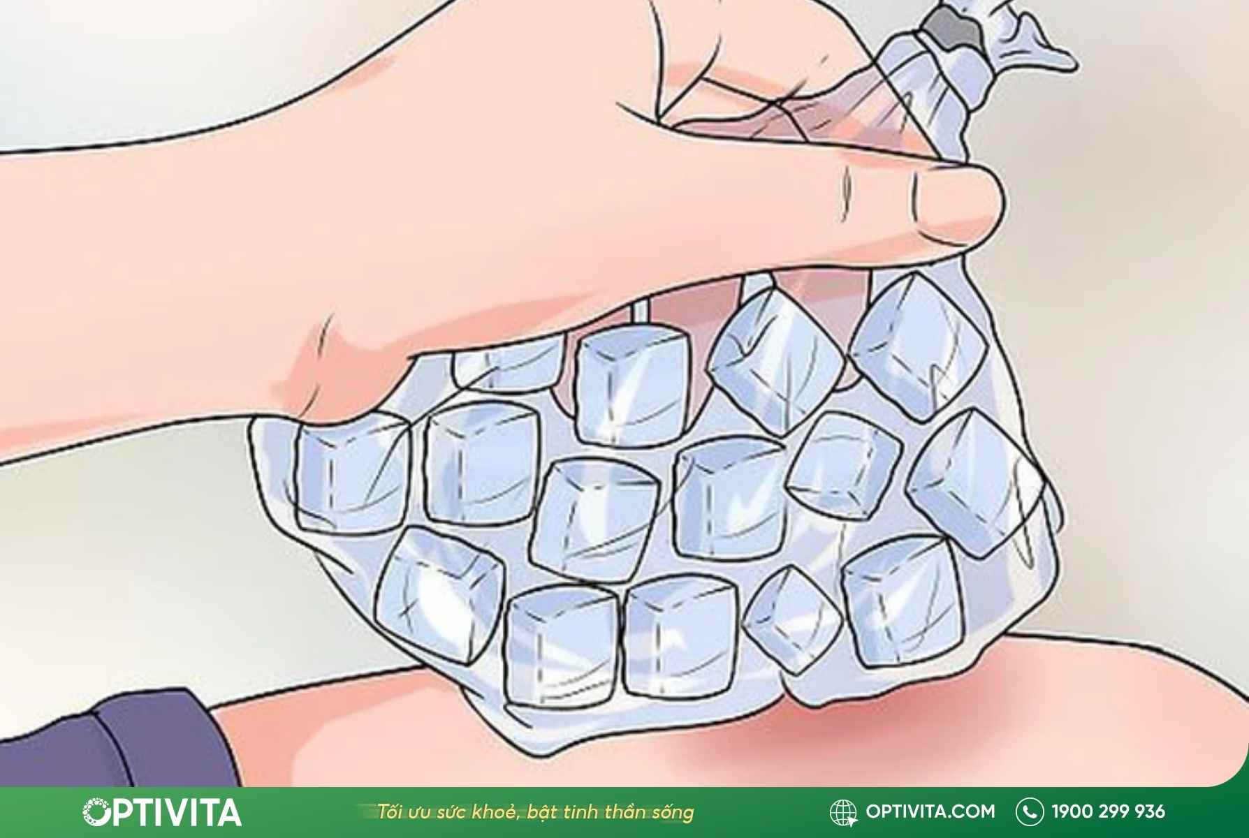 Bật mí 10+ cách giảm sưng khi bị va đập và làm tan máu bầm tại nhà hiệu quả 11 cách giảm sưng khi bị va đập