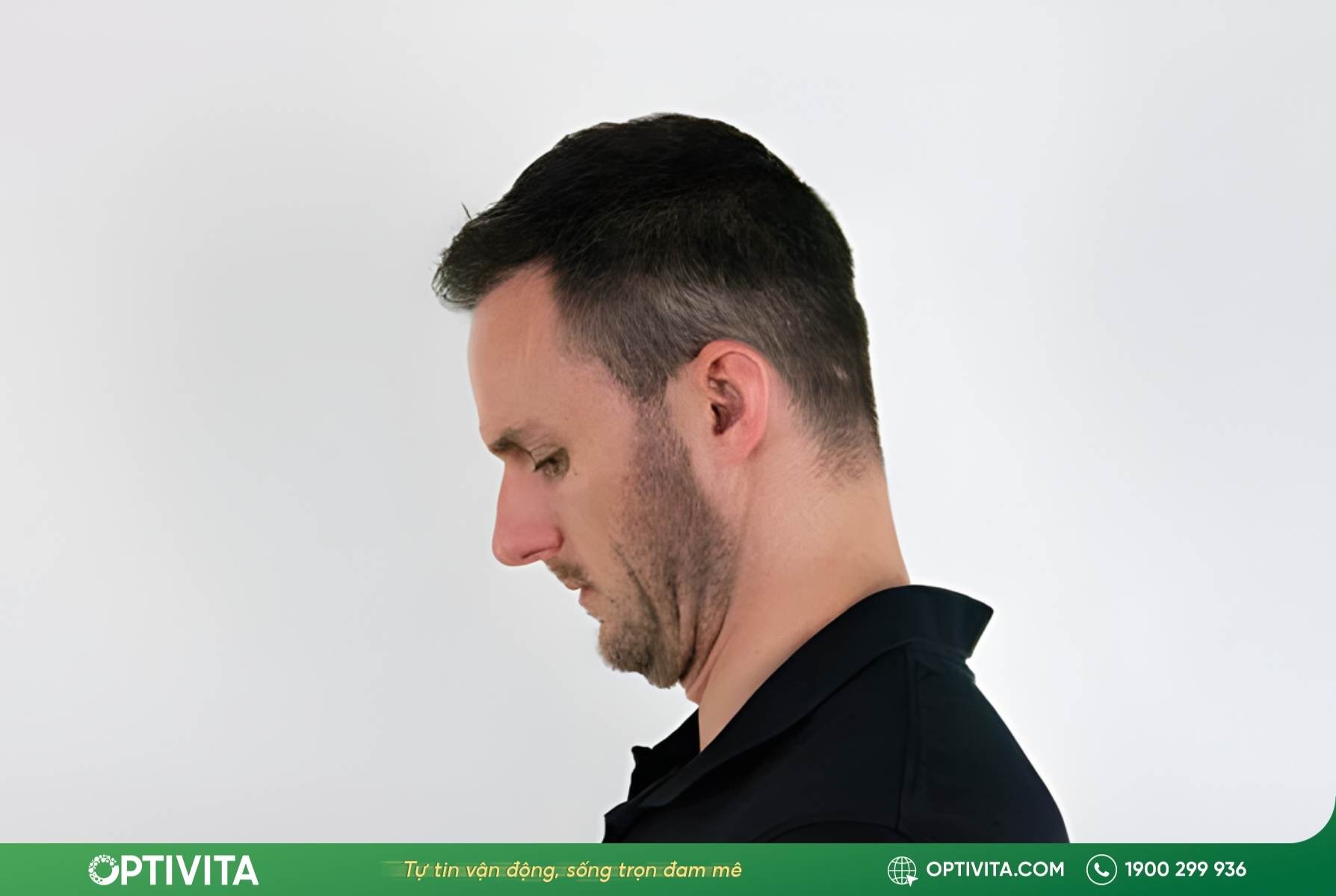 dấu hiệu thoái hóa đốt sống cổ