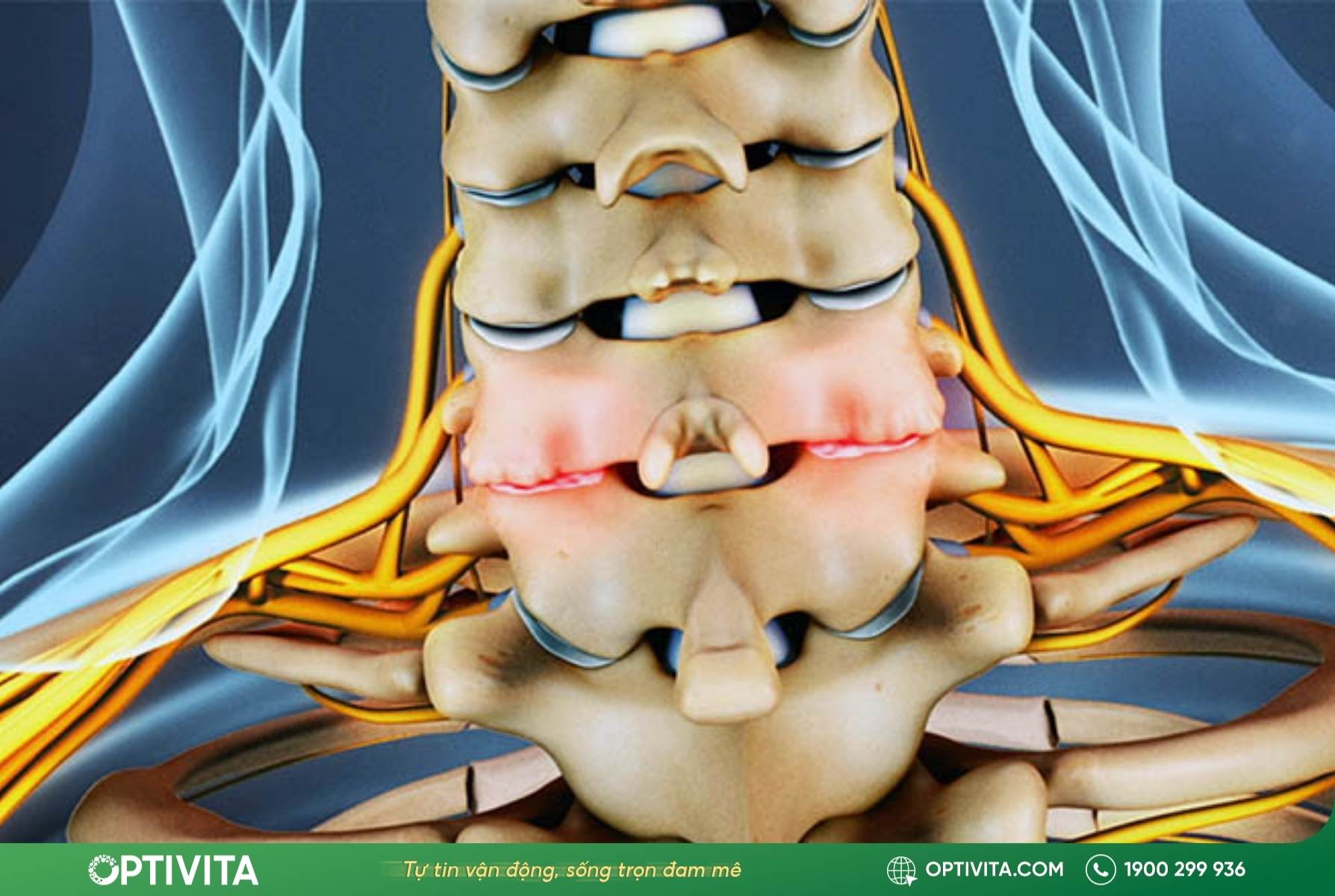 dấu hiệu thoái hóa đốt sống cổ