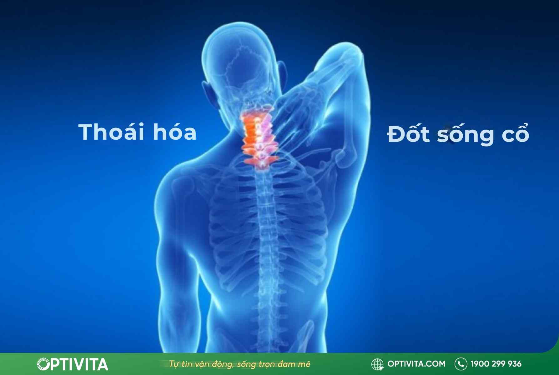 5+ sự thật về thoái hóa đốt sống cổ có chữa được không 11 thoái hóa đốt sống cổ có chữa được không