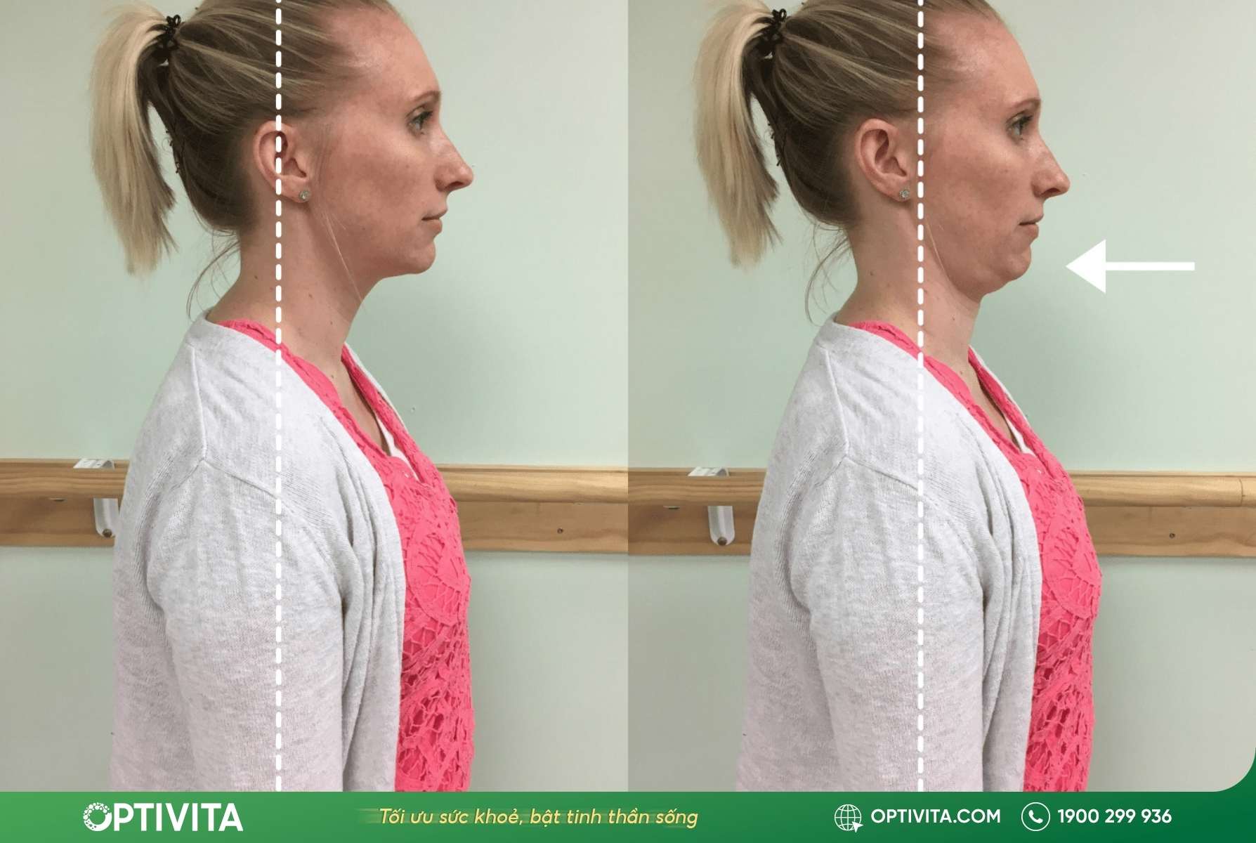 Bài tập rụt cổ (Chin Tuck)