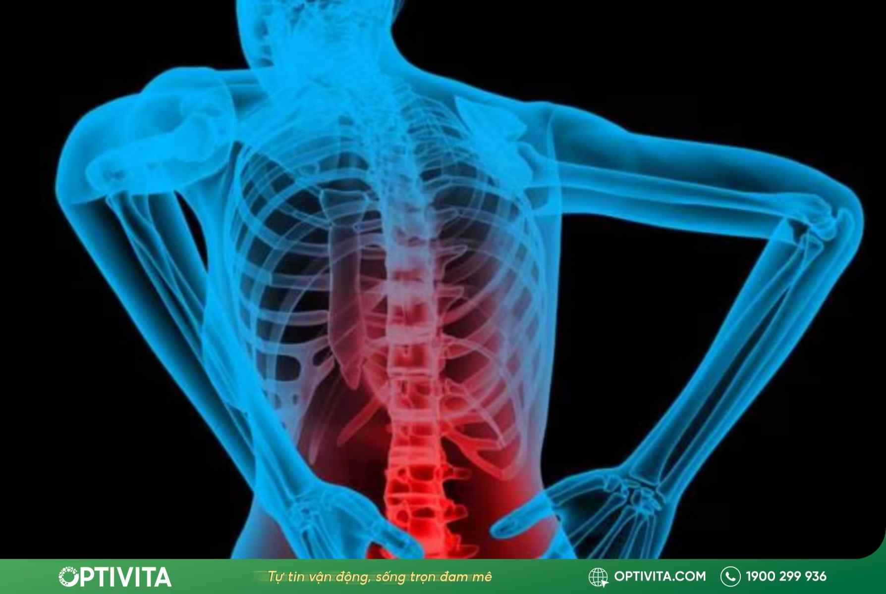 Cách trị cụp xương sống tại nhà