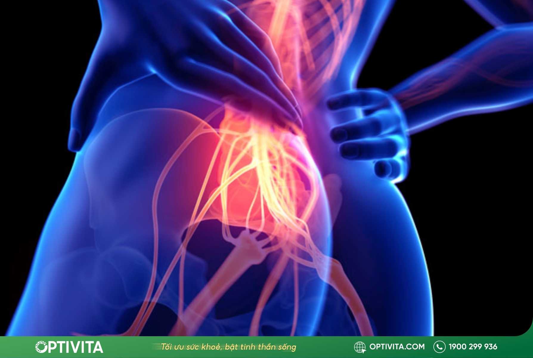 7 thủ phạm gây bị đau lưng dưới gần mông ở nam giới 11 bị đau lưng dưới gần mông ở nam giới