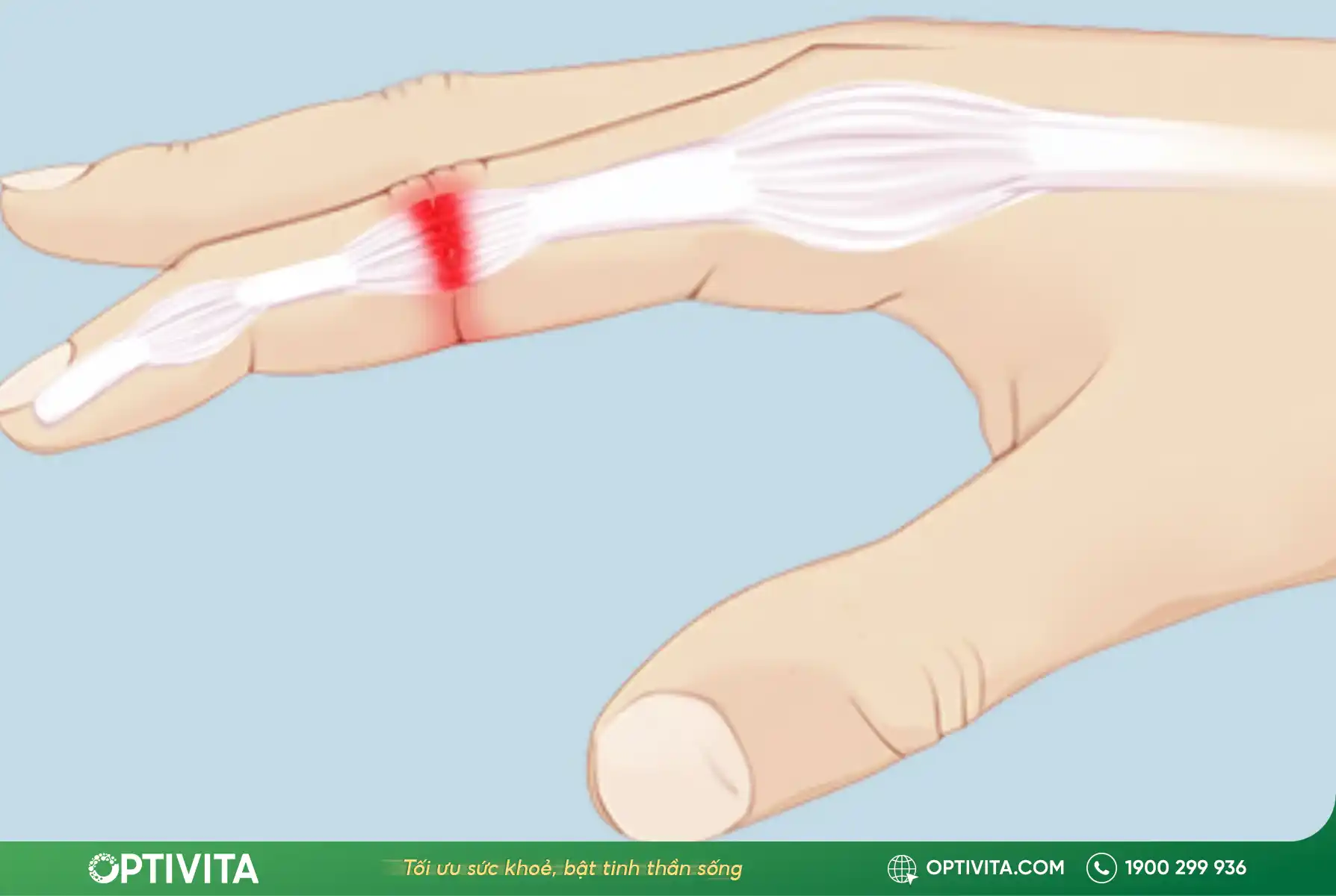 các khớp nào thường bị bong gân