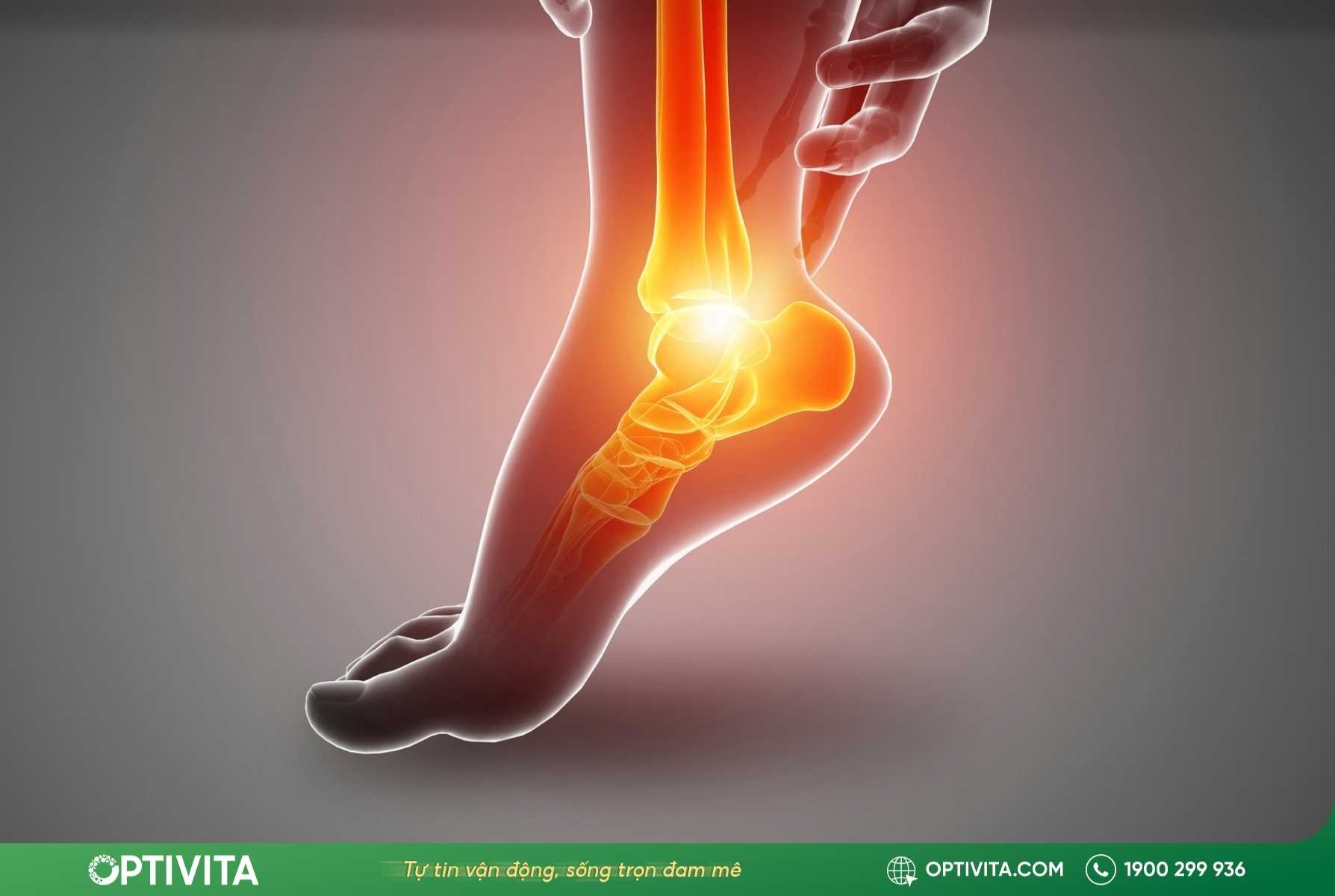 Các vị trí đau lòng bàn chân thường gặp nhất cảnh báo điều gì? 10 các vị trí đau lòng bàn chân