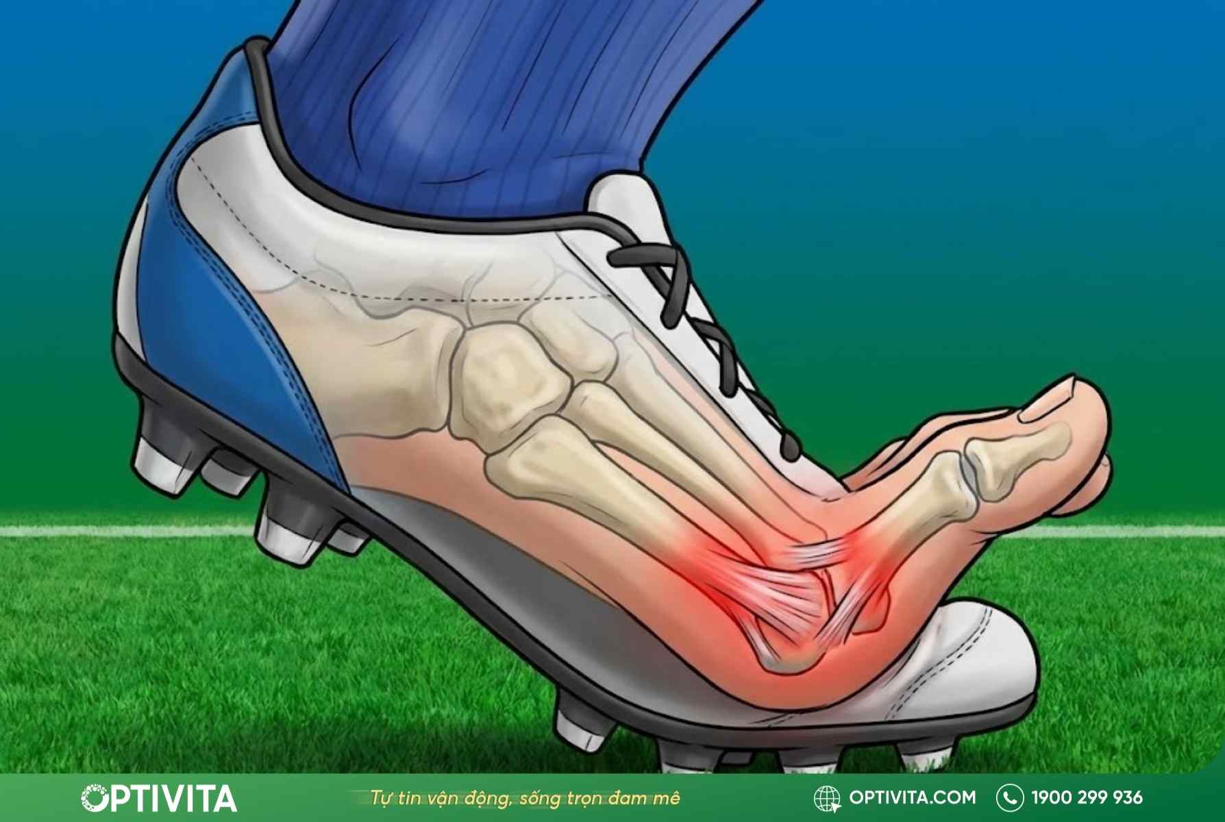 chấn thương ngón chân cái khi đá bóng