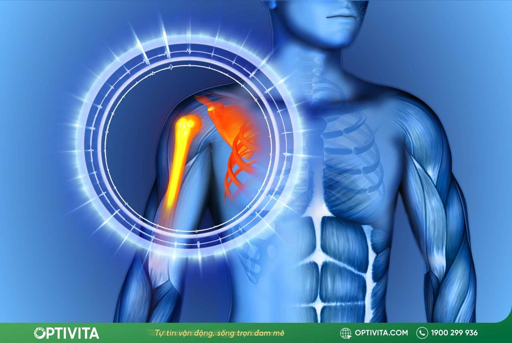 sưng xương quai xanh bên phải