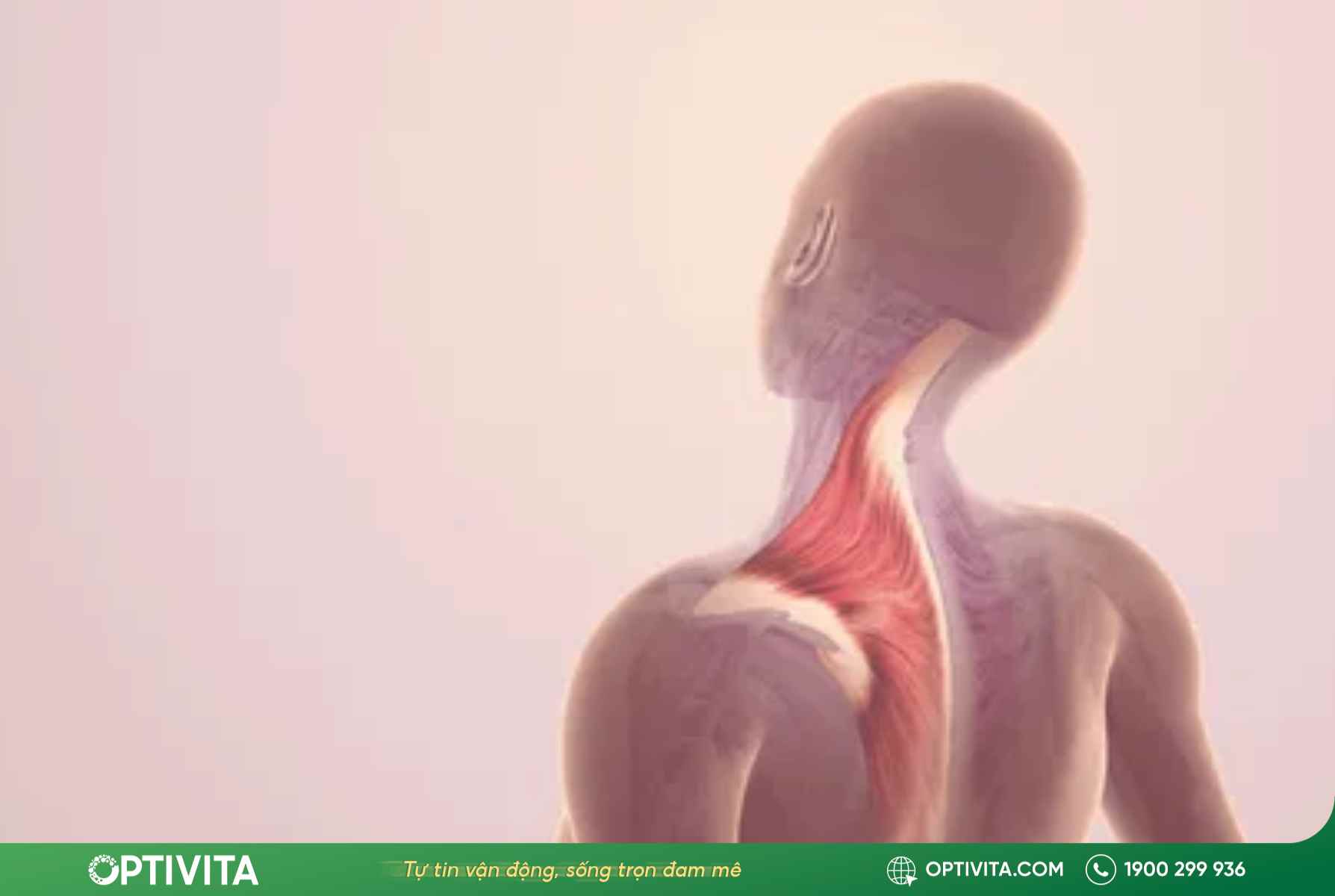 Đau vai gáy bên trái: 9 nguyên nhân nguy hiểm và cách xử lý dứt điểm 9 Đau vai gáy bên trái