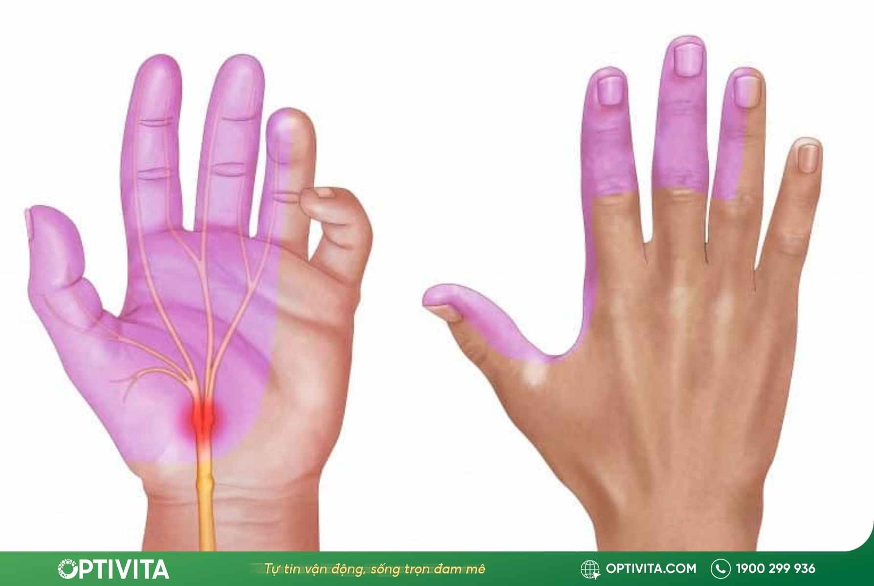 dau-hieu-hoi-chung-ong-co-tay-te-bi