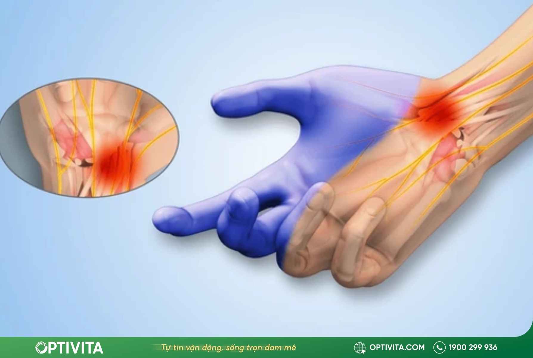 giai-phau-hoi-chung-ong-co-tay