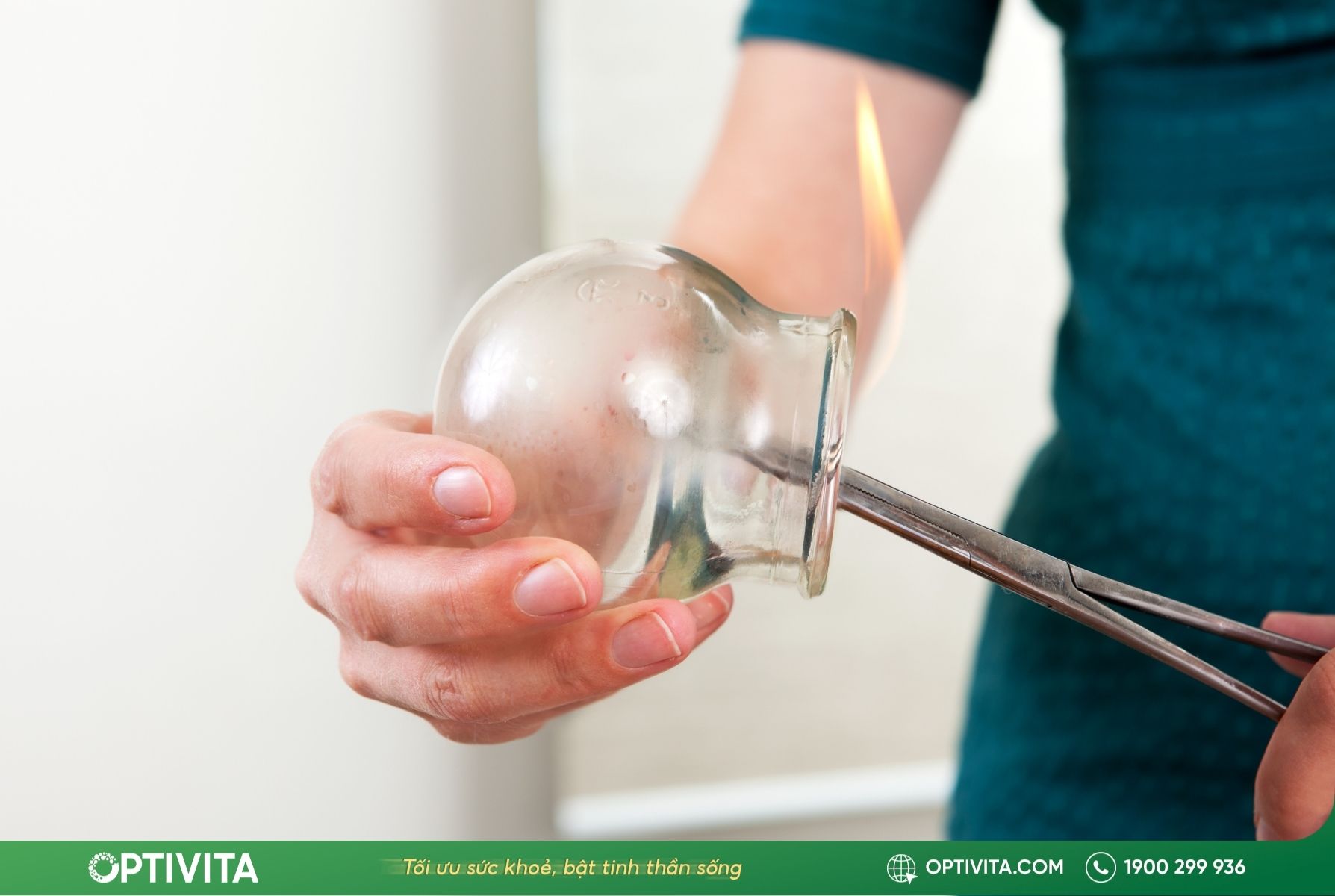 Các phương pháp giác hơi phổ biến trong chăm sóc sức khỏe hiện nay